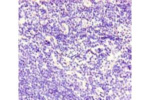 Immunohistochemistry of paraffin-embedded human lymph node tissue using ABIN7148573 at dilution of 1:100 (Corneodesmosin anticorps  (AA 40-229))