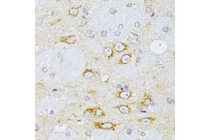 Immunohistochemistry of paraffin-embedded rat brain using CCND1 antibody. (Cyclin D1 anticorps  (C-Term))