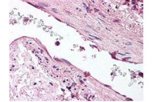 anti-ANG1 antibody was diluted 1:500 to detect ANG1 in human lung tissue. (Angiopoietin 1 anticorps)