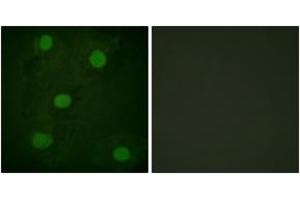 Immunofluorescence analysis of HeLa cells, using p53 (Ab-317) Antibody. (p53 anticorps  (AA 283-332))