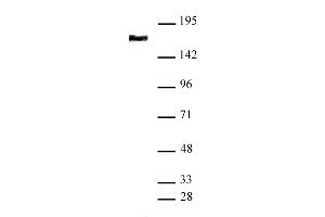 SMC4 antibody (pAb) tested by Western blot Nuclear extract of HeLa cells (20 μg) probed with SMC4 antibody (1:1,000). (SMC4 anticorps  (N-Term))