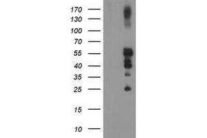 Western Blotting (WB) image for anti-Protein tyrosine Phosphatase, Non-Receptor Type 1 (PTPN1) antibody (ABIN1500496)
