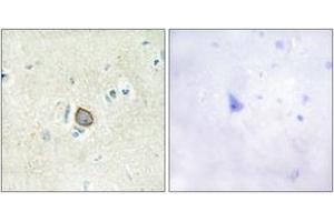 Immunohistochemistry analysis of paraffin-embedded human brain tissue, using CELSR3 Antibody. (CELSR3 anticorps  (AA 91-140))
