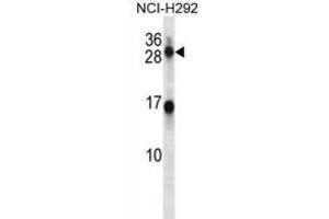 Western Blotting (WB) image for anti-Kallikrein 14 (KLK14) antibody (ABIN2998264) (Kallikrein 14 anticorps)