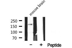 Western blot analysis of extracts from mouse brain, using CLASP1 antibody. (CLASP1 anticorps  (Internal Region))