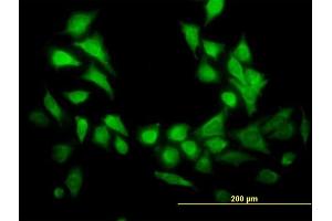 Immunofluorescence of  purified  MaxPab antibody to GENX-3414 on HeLa cell. (STBD1 anticorps  (AA 1-358))