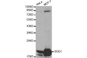 Western blot analysis of extracts of various cell lines, using SOD1 antibody (ABIN5970104) at 1/1000 dilution. (SOD1 anticorps)