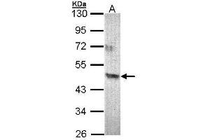 WB Image Sample (30 ug of whole cell lysate) A: 293T 10% SDS PAGE antibody diluted at 1:500 (Acad8 anticorps)