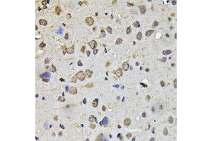 Immunohistochemistry of paraffin-embedded rat brain using HPGD antibody (ABIN2563240) at dilution of 1:100 (40x lens). (HPGD anticorps)
