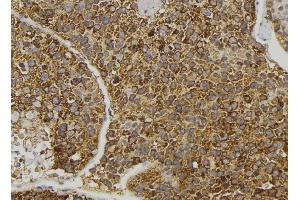ABIN6274096 at 1/100 staining Human pancreas tissue by IHC-P.
