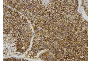 ABIN6274096 at 1/100 staining Human pancreas tissue by IHC-P. (EPH Receptor B6 anticorps  (Internal Region))