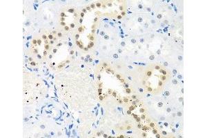 Immunohistochemistry of paraffin-embedded Rat kidney using THOC1 Polyclonal Antibody at dilution of 1:100 (40x lens). (THOC1 anticorps)