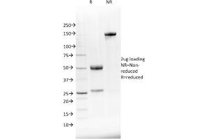 SDS-PAGE Analysis Purified NKX2. (NKX2-8 anticorps  (AA 10-123))