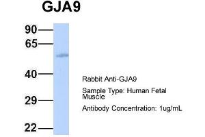 Host: Rabbit Target Name: GJA9 Sample Type: Human Fetal Muscle Antibody Dilution: 1. (GJA9 anticorps  (Middle Region))