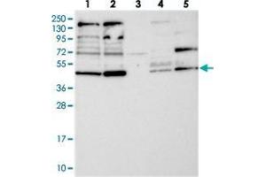 Western blot analysis of Lane 1: RT-4, Lane 2: U-251 MG, Lane 3: Human Plasma, Lane 4: Liver, Lane 5: Tonsil with RNF44 polyclonal antibody  at 1:250-1:500 dilution. (RNF44 anticorps)