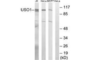 Western blot analysis of extracts from MCF-7/HeLa/Jurkat cells, using USO1 Antibody. (USO1 anticorps  (AA 913-962))