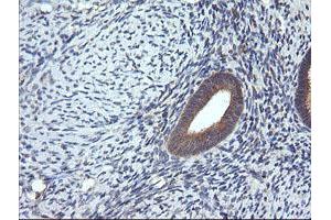 Image no. 9 for anti-Ras Homolog Gene Family, Member J (RHOJ) antibody (ABIN1501341)