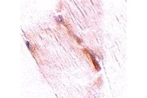 Immunohistochemistry (IHC) image for anti-Glioblastoma Amplified Sequence (GBAS) (Middle Region) antibody (ABIN1031016) (GBAS anticorps  (Middle Region))