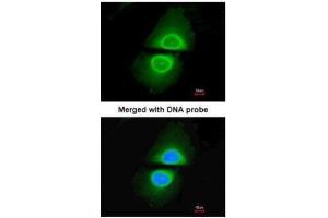 ICC/IF Image Immunofluorescence analysis of paraformaldehyde-fixed HeLa, using Cytochrome P450 4A11, antibody at 1:200 dilution. (CYP4A11 anticorps  (Center))