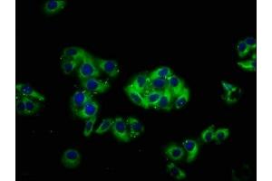 Immunofluorescence staining of HepG2 cells with ABIN7148519 at 1:66, counter-stained with DAPI.