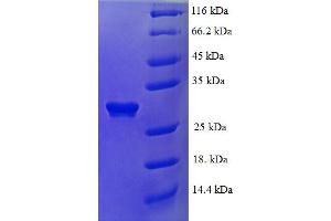 SDS-PAGE (SDS) image for Glial Cell Line Derived Neurotrophic Factor (GDNF) (AA 78-211) protein (His-SUMO Tag) (ABIN5709569)