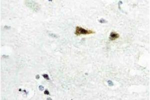Immunohistochemistry analysis of c-Abl Antibody in paraffin-embedded human brain tissue. (ABL1 anticorps)