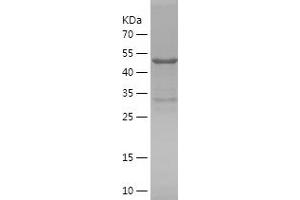 Western Blotting (WB) image for Synaptic Ras GTPase Activating Protein 1 (SYNGAP1) (AA 71-340) protein (His-IF2DI Tag) (ABIN7125266)