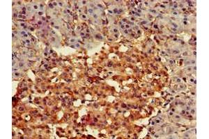Immunohistochemistry of paraffin-embedded human pancreatic tissue using ABIN7153185 at dilution of 1:100 (FZD4 anticorps  (AA 37-222))