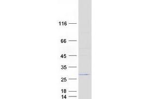 Validation with Western Blot