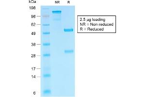 anti-Chorionic Gonadotropin, beta Polypeptide (CGB) antibody