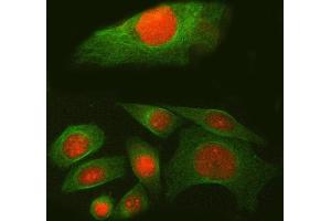 IF analysis of SPAG7 using anti-SPAG7 antibody (ABIN7599072) and anti-Tubulin Alpha antibody (ABIN7600339). (SPAG7 anticorps  (AA 1-199))