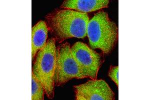 Fluorescent confocal image of  cell stained with RELA Antibody (Center) (ABIN1881740 and ABIN2838805).