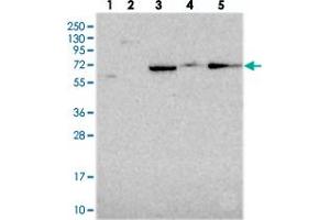 Western blot analysis of Lane 1: RT-4, Lane 2: U-251 MG, Lane 3: Human Plasma, Lane 4: Liver, Lane 5: Tonsil with ALDH1A3 polyclonal antibody  at 1:250-1:500 dilution. (ALDH1A3 anticorps)