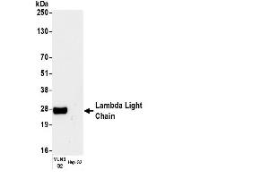 Rabbit anti-Human lambda Light Chain (Lambda-IgLC) antibody