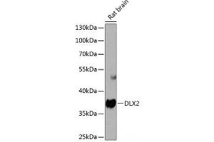 Western blot analysis of extracts of Rat brain using DLX2 Polyclonal Antibody at dilution of 1:1000.