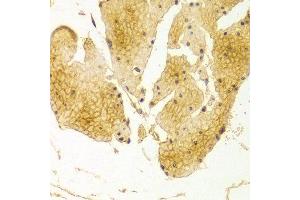 Immunohistochemistry of paraffin-embedded Human esophageal using BSG antibody at dilution of 1:100 (x400 lens).