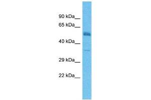 Host:  Rabbit  Target Name:  TMEFF2  Sample Type:  Colorectal Tumor lysates  Antibody Dilution:  1. (TMEFF2 anticorps  (C-Term))