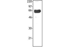 Image no. 1 for anti-Triggering Receptor Expressed On Myeloid Cells 1 (TREM1) antibody (ABIN205544)