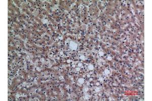 Immunohistochemistry (IHC) analysis of paraffin-embedded Human Liver, antibody was diluted at 1:100.