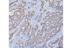 IHC analysis of Cytokeratin 8/KRT8 using anti-Cytokeratin 8/KRT8 antibody (ABIN5518853).