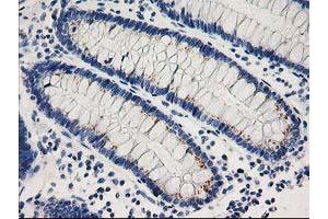 Immunohistochemistry (IHC) image for anti-Cyclin-Dependent Kinase 2 (CDK2) antibody (ABIN1497394) (CDK2 anticorps)