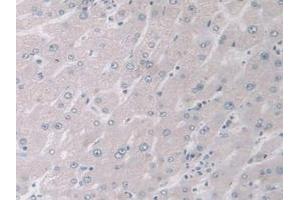 Detection of MAPK12 in Human Liver Tissue using Polyclonal Antibody to Mitogen Activated Protein Kinase 12 (MAPK12) (MAPK12 anticorps  (AA 27-311))