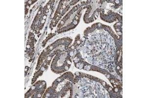 Immunohistochemical staining of human colon with CALHM2 polyclonal antibody  shows strong cytoplasmic positivity in glandular cells. (CALHM2 anticorps)