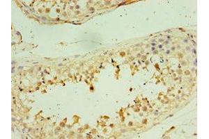 Immunohistochemistry of paraffin-embedded human testis tissue using ABIN7171237 at dilution of 1: 100 (STX3 anticorps  (AA 1-263))
