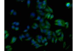 Immunofluorescence staining of HepG2 cells with ABIN7173778 at 1:50, counter-stained with DAPI. (TNFAIP8L1 anticorps  (AA 1-186))