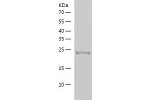 Western Blotting (WB) image for Methyl-CpG Binding Domain Protein 4 (MBD4) (AA 68-300) protein (His-IF2DI Tag) (ABIN7123938)
