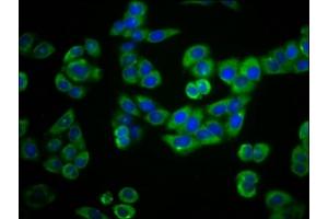 Immunofluorescence staining of PC-3 cells with ABIN7163650 at 1:66, counter-stained with DAPI.