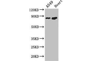 Western Blot Positive WB detected in: A549 whole cell lysate, Mouse heart tissue All lanes: PFKM antibody at 3. (PFKM anticorps  (AA 166-334))
