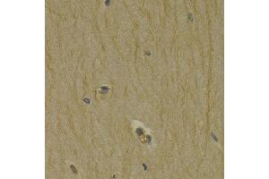 anti-Dopamine Receptor D3 (DRD3) (AA 213-329) antibody