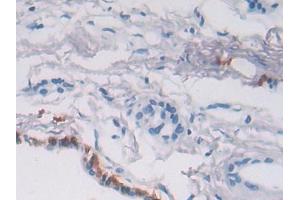 DAB staining on IHC-P; Samples: Human Pancreas Tissue (P4HA2 anticorps  (AA 207-520))